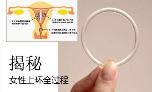什么時(shí)候上環(huán) 上環(huán)的最佳時(shí)間