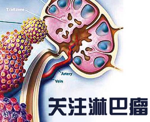 世界十大痛苦癌癥排行,胃癌發(fā)病率高,肺癌死亡率最快
