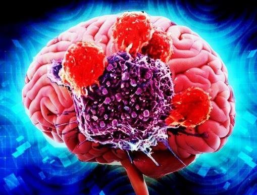 世界十大痛苦癌癥排行,胃癌發(fā)病率高,肺癌死亡率最快