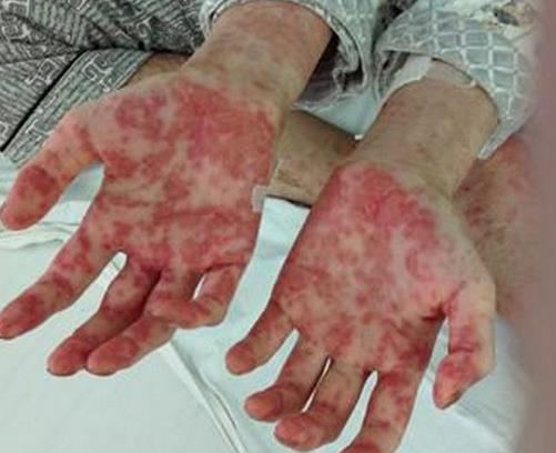世界十大痛苦癌癥排行,胃癌發(fā)病率高,肺癌死亡率最快
