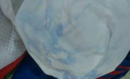衣服染色如何去掉 衣服染色去除小竅門(mén)