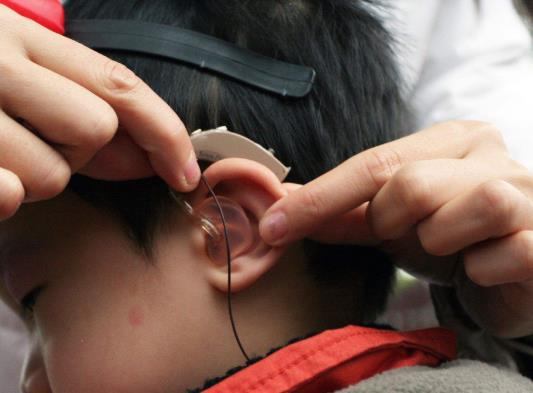 人工耳蝸需要開(kāi)顱嗎?做人工耳蝸影響睡眠嗎