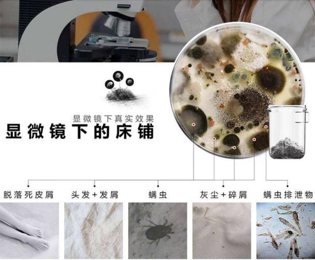 顯微鏡下的螨蟲圖片