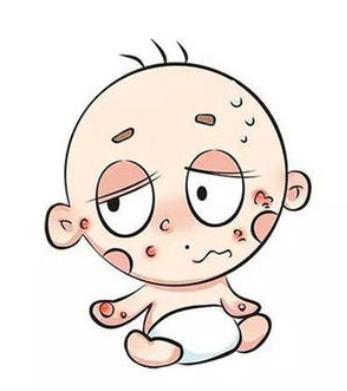 過敏體質(zhì)不能吃什么?吃什么可以改善過敏體質(zhì)?