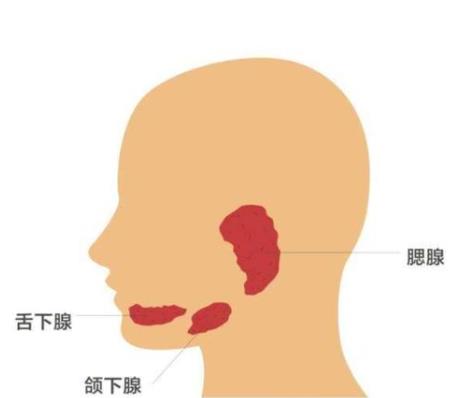 腮腺炎的癥狀是什么?腮腺炎不能吃什么