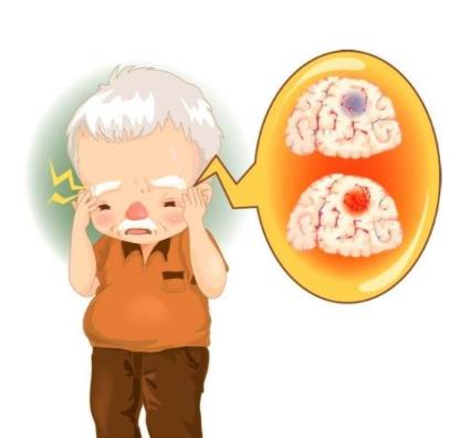 腦梗塞的危害是什么?腦梗塞不能吃什么