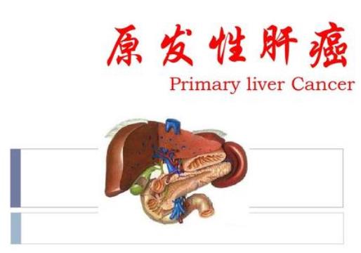 原發(fā)性肝癌不能吃什么?原發(fā)性肝癌的早期癥狀