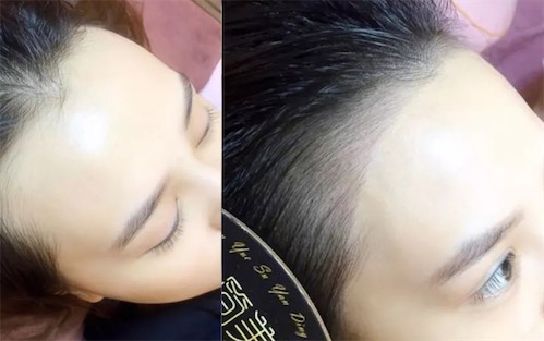 一望無際是什么意思什么梗 一望無際指一眼望過去看不到發(fā)際線