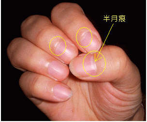 指甲上的半月痕你懂多少？指甲半月痕與健康吉兇