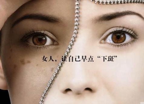 經(jīng)期延長引發(fā)黃褐斑怎么辦？如何預(yù)防黃褐斑