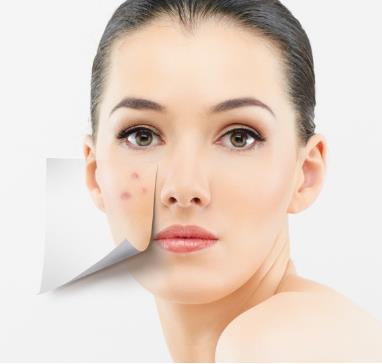 臉上長痘痘是什么原因？臉上長痘痘怎么調(diào)理？青春痘怎么消除