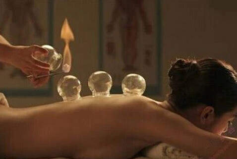 拔火罐能減肥嗎？拔火罐減肥的壞處