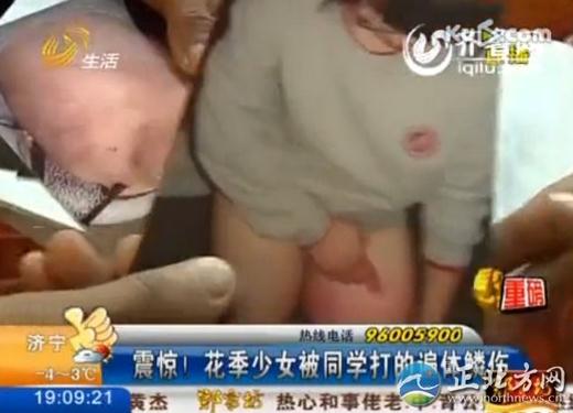 16歲花季少女被四名室友毆打4小時，脫光了跪在地上打，打得遍體鱗傷