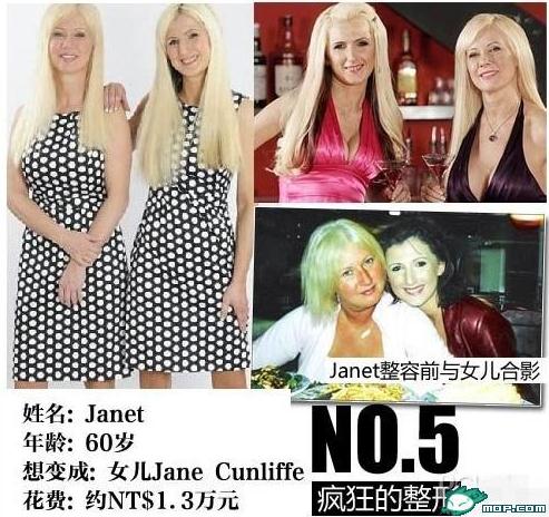 坑爹時(shí)代：那些奇葩的瘋狂變臉整容，坑爹呀