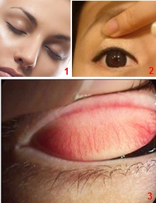 眼睛里進(jìn)東西怎么辦？眼睛進(jìn)異物怎么辦