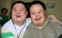 什么是唐氏綜合癥？