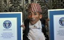 世界上最矮成人男子去世，享年75歲