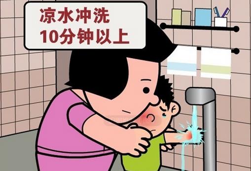 被開水燙傷怎么辦？應(yīng)急措施介紹