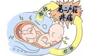 【順產(chǎn)】順產(chǎn)與剖腹產(chǎn)的區(qū)別_順產(chǎn)疼嗎_哪些人不適合順產(chǎn)_無(wú)痛自然分娩是什么