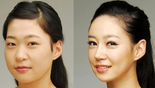 咬肌瘦臉針有什么危害？