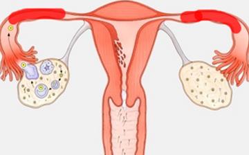 【女性生殖器結(jié)核】女性生殖器結(jié)核有哪些癥狀_女性生殖器結(jié)核如何治療_女性生殖器結(jié)核的原因 【女性生殖器結(jié)核】女性生殖器結(jié)核有哪些癥狀_女性生殖器結(jié)核如何治療_女性生殖器結(jié)核的原因