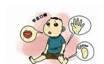 什么是手足口??？手足口病怎么治療