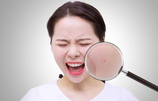 痘痘怎么消除,及時護(hù)理是必要的,如果臉上出現(xiàn)痘痘不要