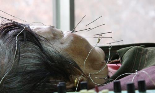 警惕！氣溫驟變，多人中招口眼歪斜、面部麻木……此季高