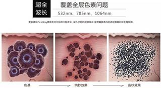寧波薇琳整形醫(yī)院祛斑怎么樣？還您一張漂亮的容顏