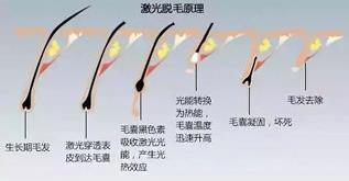 寧波薇琳整形醫(yī)院祛斑怎么樣？還您一張漂亮的容顏