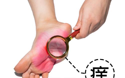 有腳氣的人，經(jīng)常用鹽水泡腳就能消滅真菌嗎？它沒有這個