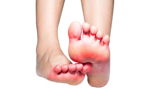 有腳氣的人，經(jīng)常用鹽水泡腳就能消滅真菌嗎？它沒有這個