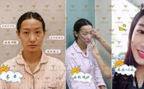 自體多肽脂肪實現(xiàn)新突破，塑造無法復(fù)制的自然美