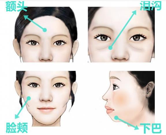 韋元強(qiáng)講解：瘦子也適合做自體脂肪填充嗎？