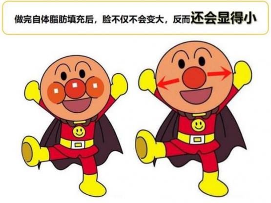韋元強(qiáng)講解：瘦子也適合做自體脂肪填充嗎？