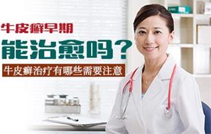 石家莊銀屑康中醫(yī)醫(yī)院好不好？誠(chéng)信立院 品質(zhì)專(zhuān)業(yè)