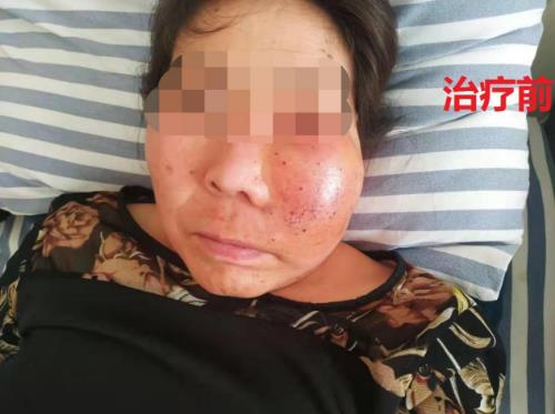 鄭州京美醫(yī)院腫瘤科好嗎？中醫(yī)專家 微創(chuàng)聯(lián)合治療