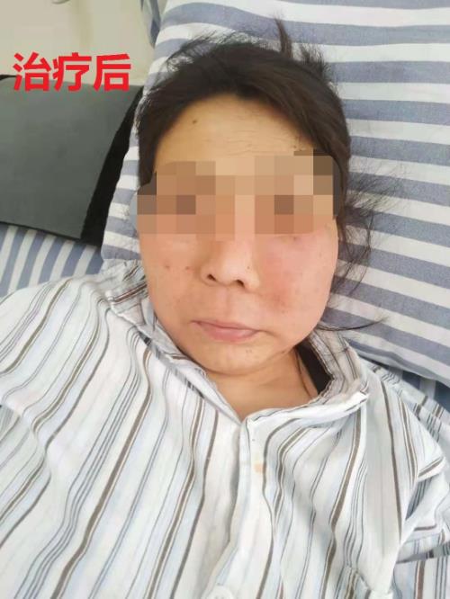 鄭州京美醫(yī)院腫瘤科好嗎？中醫(yī)專家 微創(chuàng)聯(lián)合治療