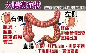 【大腸癌】早期腸癌自檢方法及早期信號癥狀_什么樣的腹痛是腸癌 【大腸癌】早期腸癌自檢方法及早期信號癥狀_什么樣的腹痛是腸癌