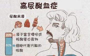 【血尿酸】血尿酸偏高的原因怎么辦_血尿酸正常值_血尿酸是查什么項(xiàng)目 【血尿酸】血尿酸偏高的原因怎么辦_血尿酸正常值_血尿酸是查什么項(xiàng)目