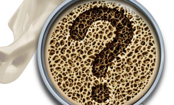 骨質(zhì)疏松的10個認知誤區(qū)，你中了沒？