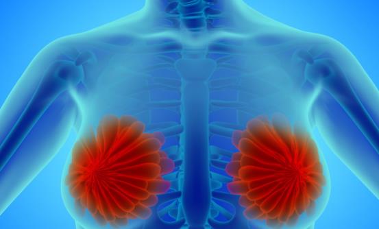 乳腺結(jié)節(jié)一定要切除嗎 需要及時(shí)手術(shù)治療的情況