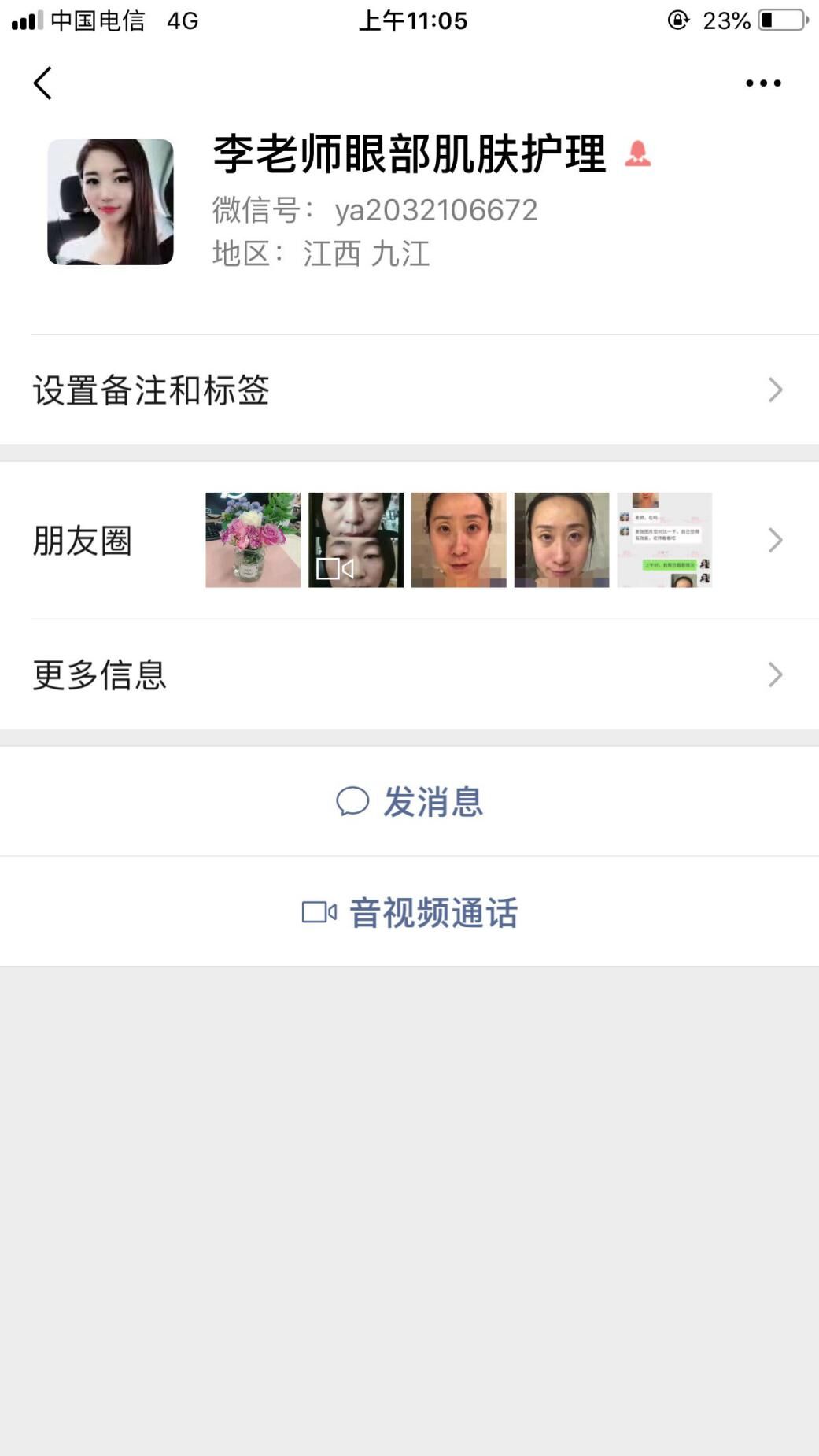 衛(wèi)婭日記：我一直都以為眼袋對(duì)我的影響只是美觀，直到我了解了以后……