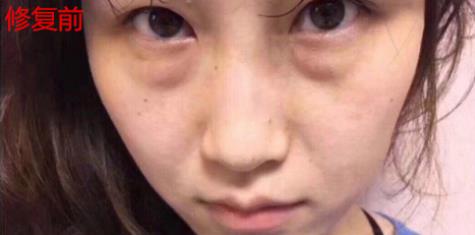 衛(wèi)婭日記：我一直都以為眼袋對(duì)我的影響只是美觀，直到我了解了以后……