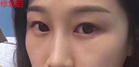 衛(wèi)婭日記：我一直都以為眼袋對(duì)我的影響只是美觀，直到我了解了以后……