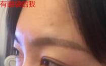 衛(wèi)婭日記:我一直都以為眼袋對(duì)我的影響只是美觀,直到我了解以后……