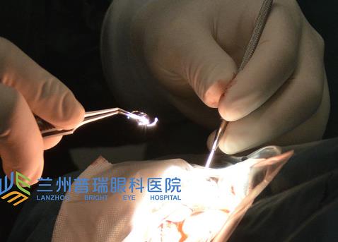 蘭州普瑞眼科治療白內(nèi)障怎么樣？預(yù)防白內(nèi)障從年輕開始