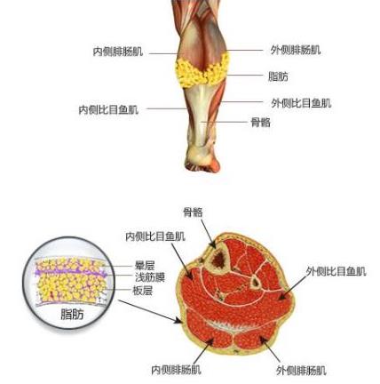 上海麗質(zhì)美學整形門診部做瘦小腿價格貴嗎？肌肉小腿太難減怎么辦