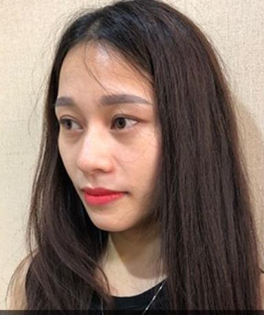 君雅筆記：眼袋過重，就會顯得比真實年齡大，要如何修復(fù)眼袋呢？