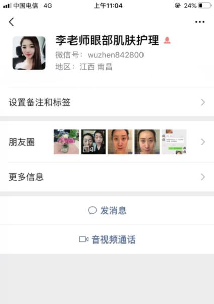 君雅筆記：眼袋過重，就會顯得比真實年齡大，要如何修復(fù)眼袋呢？